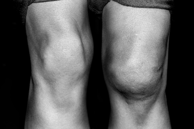 black and white photo of a persons knees